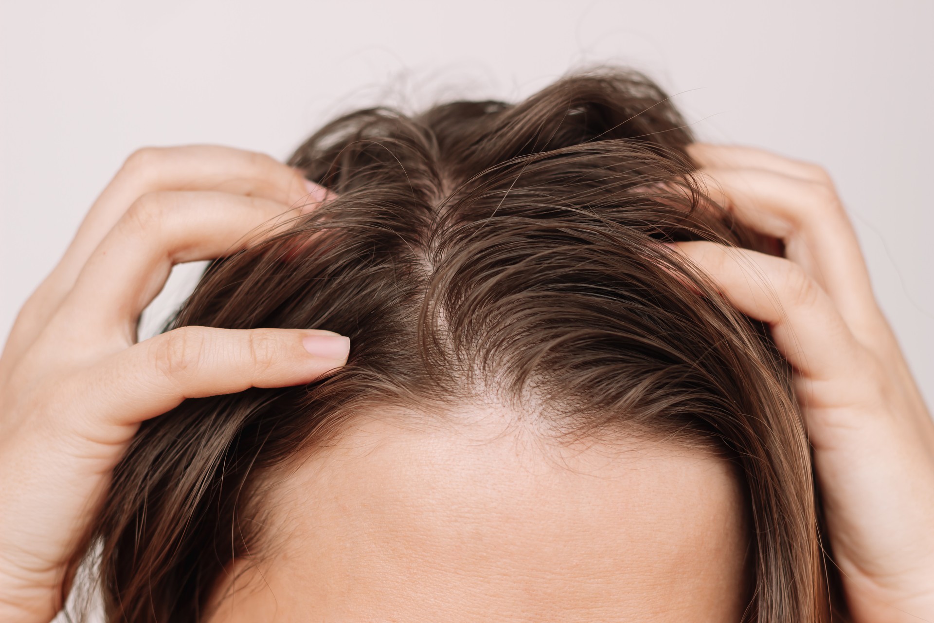 Cropped shot of a young woman with dirty greasy hair on a white background. The problem of oily scalp